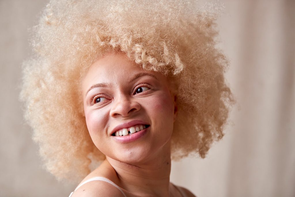 187548561 studio portrait shot of confident natural albino woman